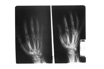 X-Rays