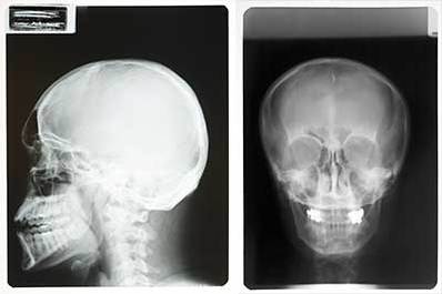 Head