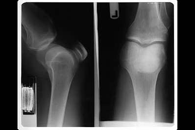 Knee