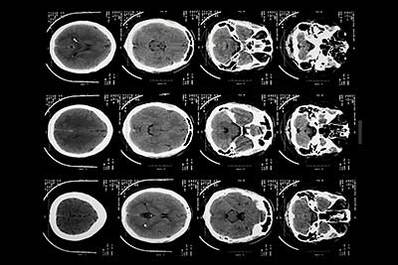 CT and MRI