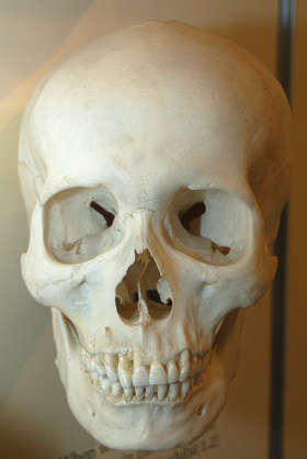 bones0057